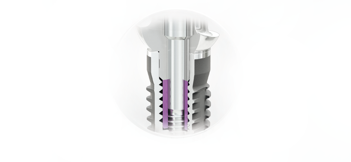 CAMLOG Tube-in-Tube Implant abutment connection CAMLOG Tube-in-Tube Implant abutment connection